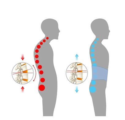Пояс для спины и поясницы (надувной пневмокорсет) от остеохондроза Spinal Air Traction Belt SAT20115 фото